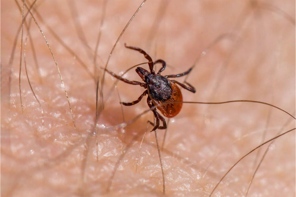 Lyme Disease in the U.S.: What You Need to Know in 2025